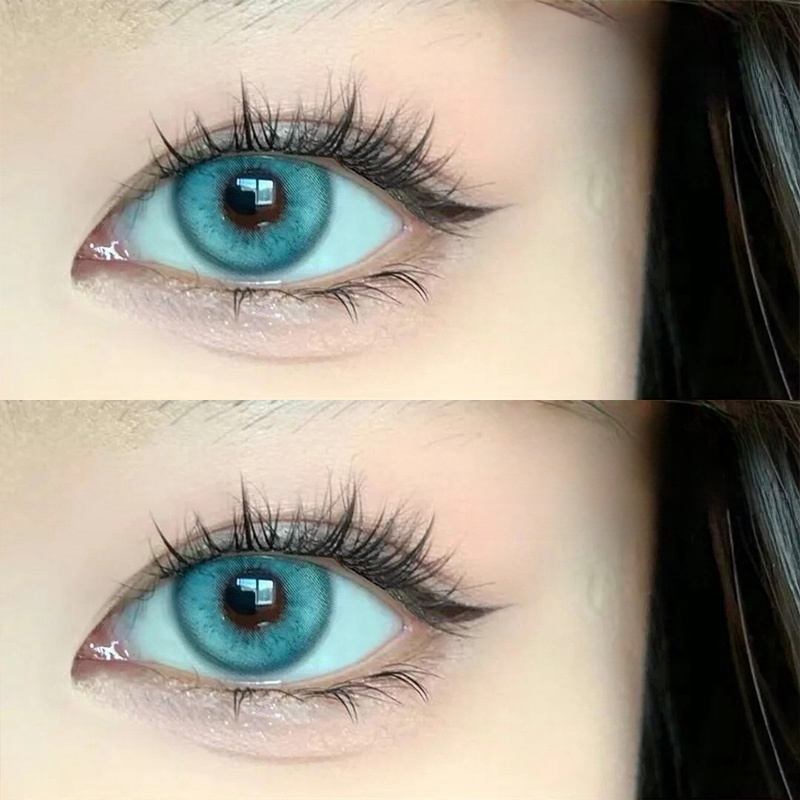 Atlantis Blue Yearly Contact Lenses