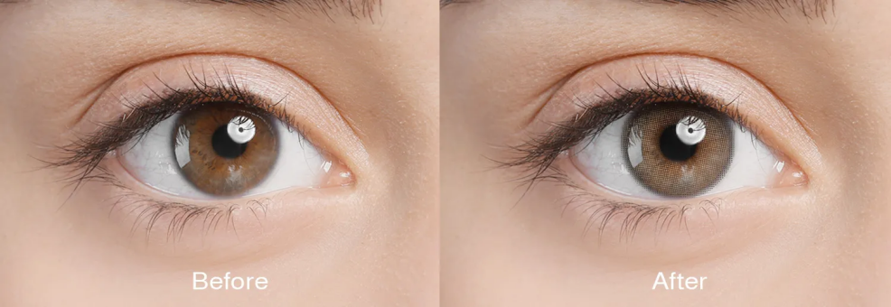 Minimal limbal ring contact lenses before and after