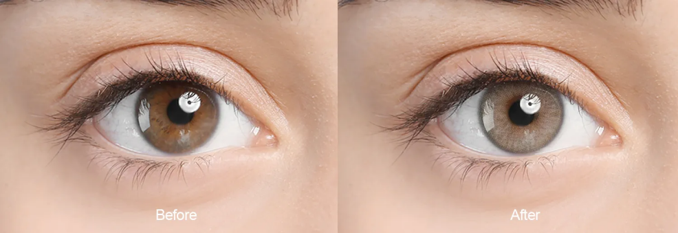 Slight limbal ring contact lenses before and after