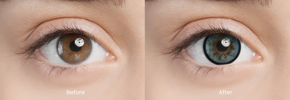 Strong limbal ring contact lenses before and after