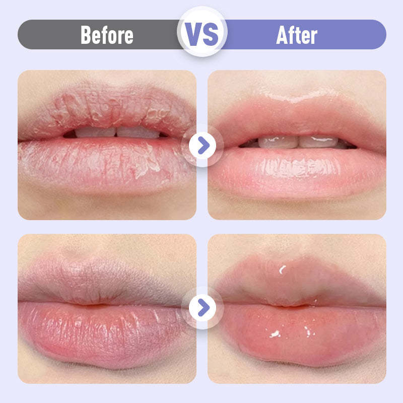 Plumping & Anti-Wrinkle Hydrating Lip Serum