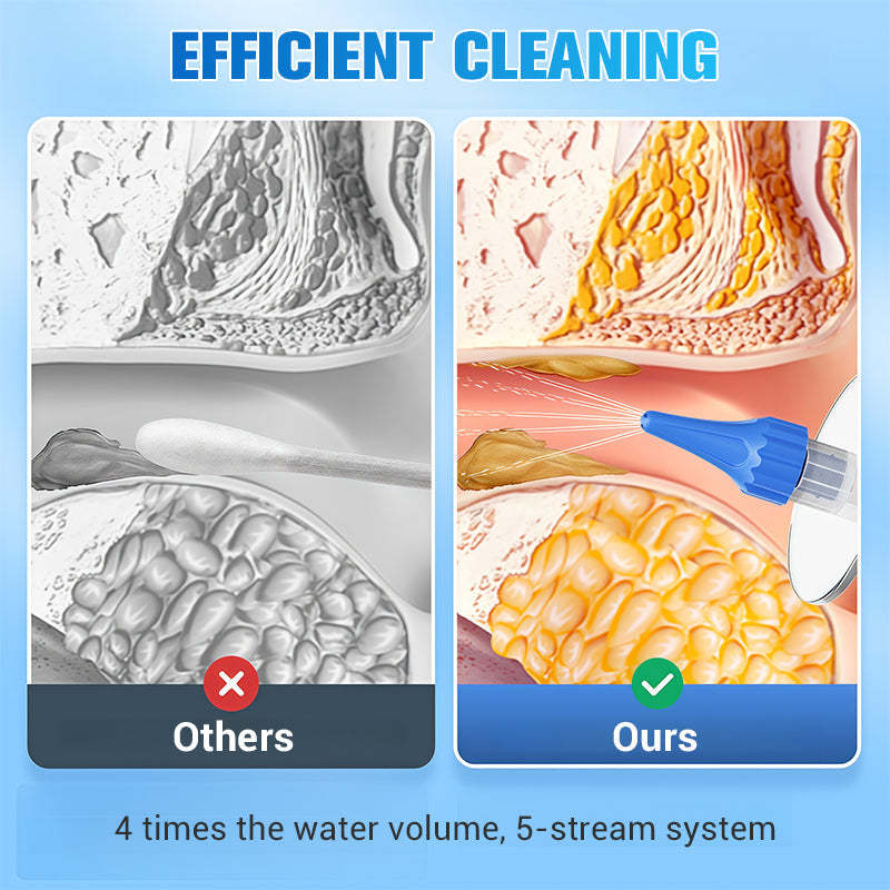 📢📢BIG SALE!!⏰👂 Ear Wax Removal Kit – Safe, Gentle & Reusable Silicone Spoon for Easy, Hygienic Ear Cleaning ✨🛡️