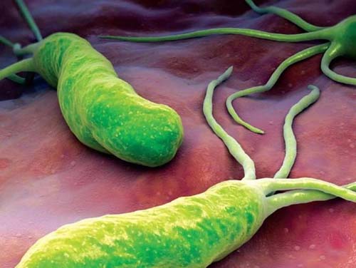 Unveiling the Health Risks: H. pylori, Fecal Occult Blood, and the Importance of Early Screening-ACCUFAST