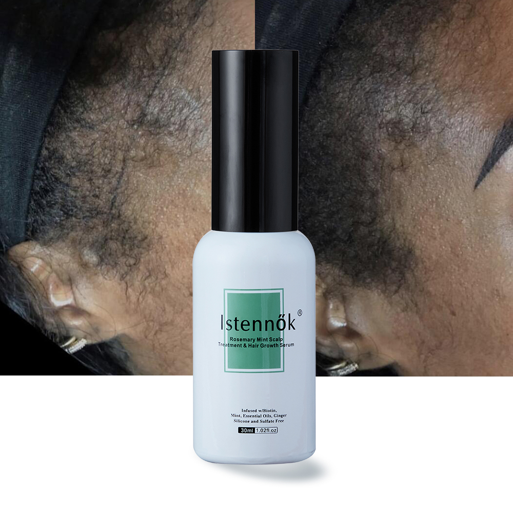 Istennők Hair Growth Oil