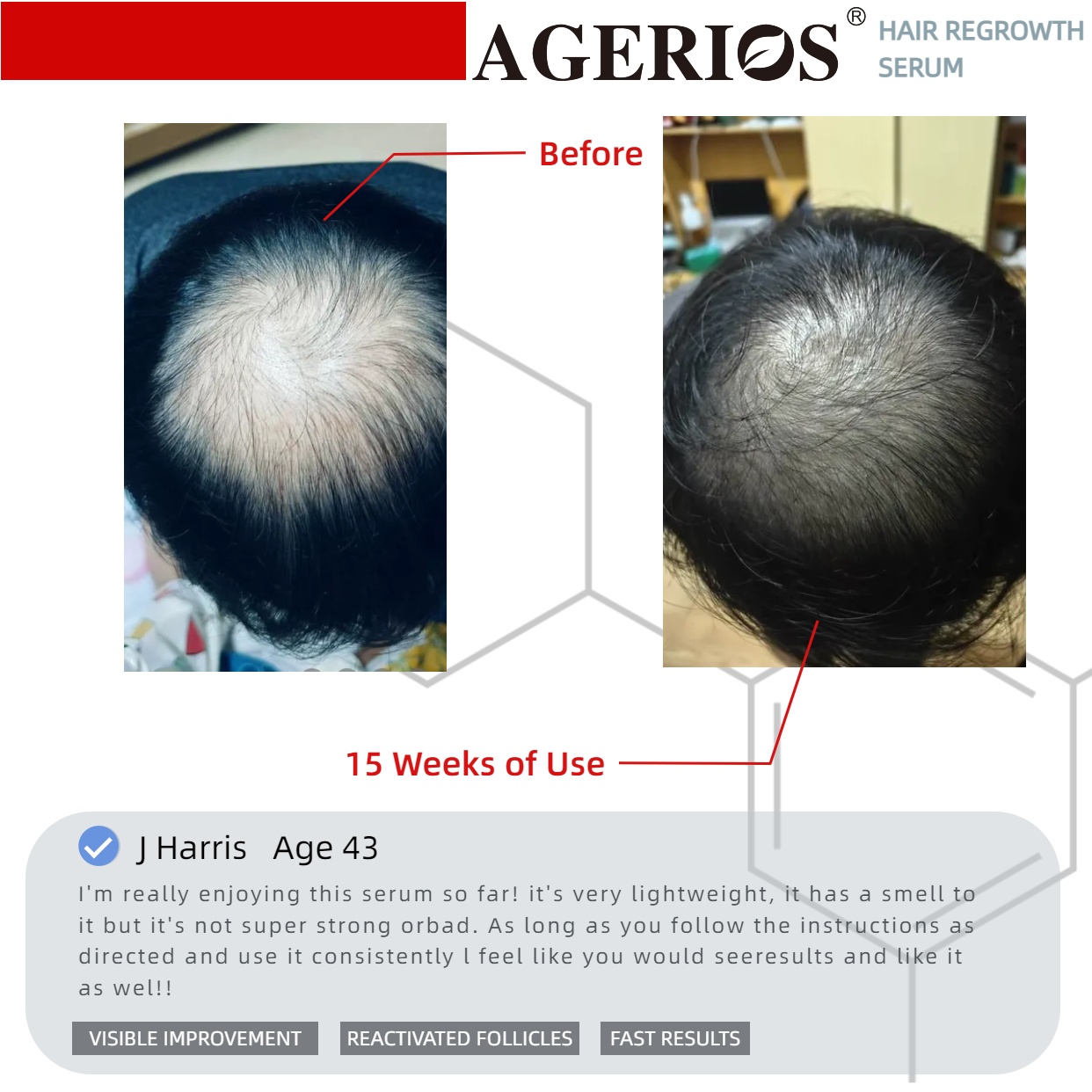 AGerios Hair Regrowth Serum