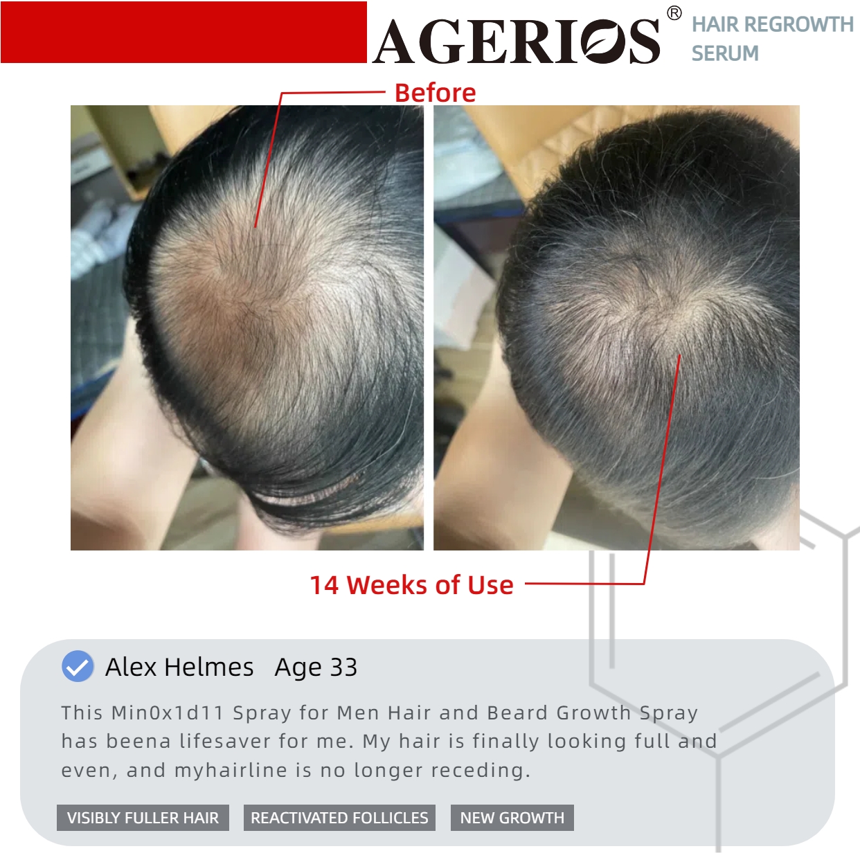 AGerios Hair Regrowth Serum