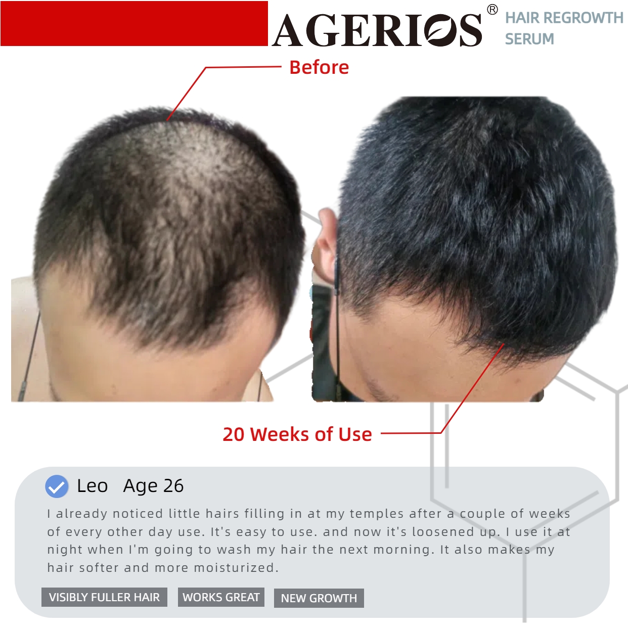 AGerios Hair Regrowth Serum