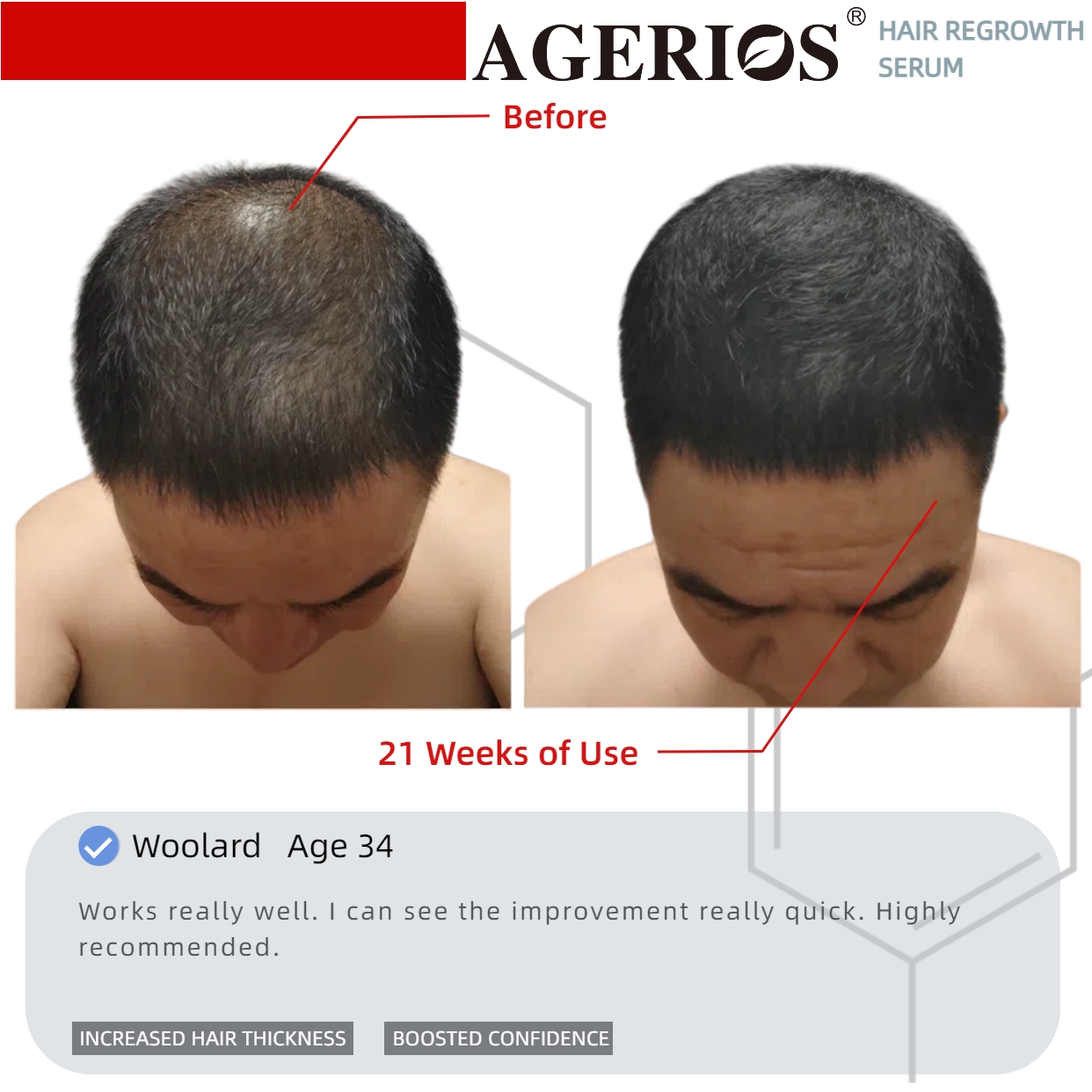 AGerios Hair Regrowth Serum