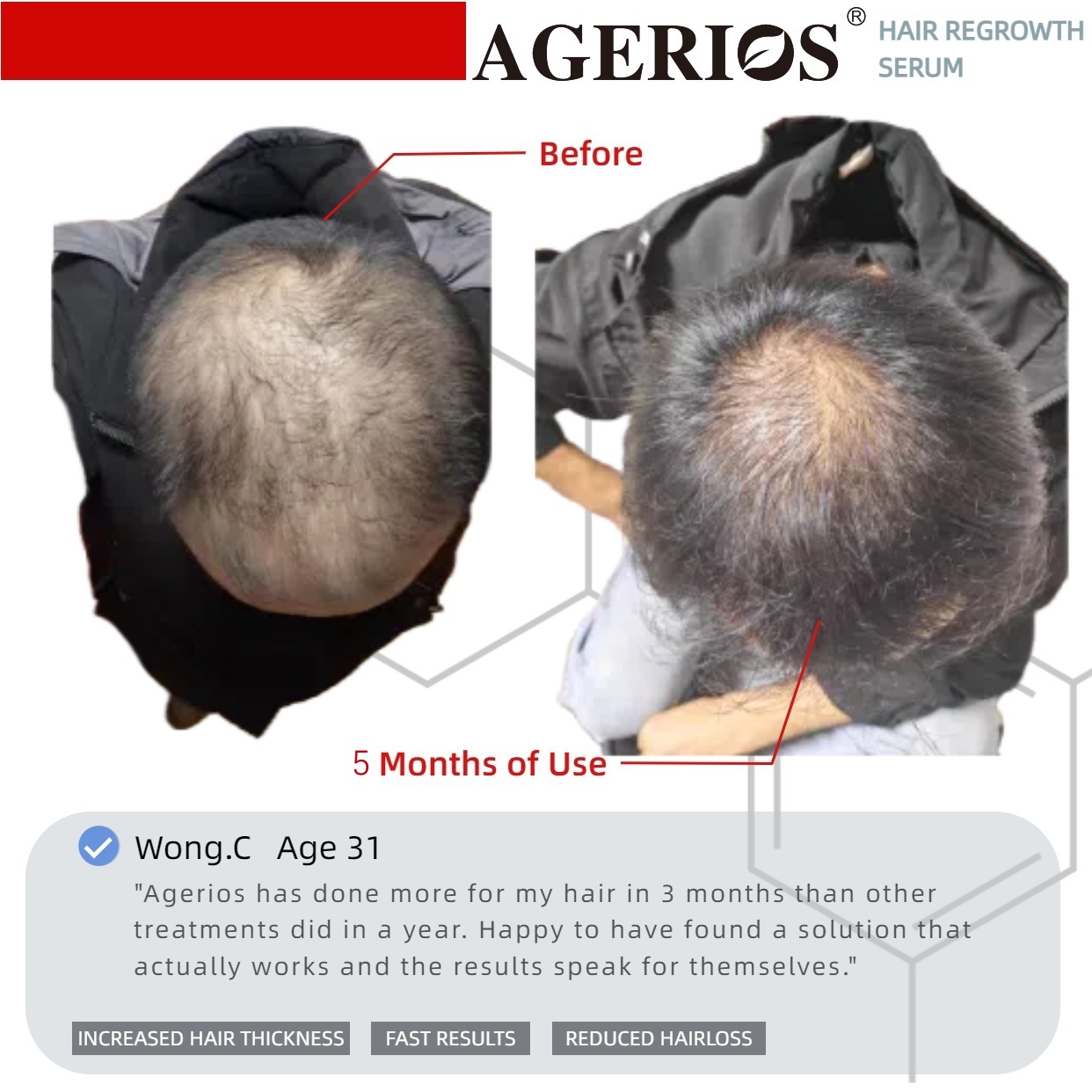 AGerios Hair Regrowth Serum