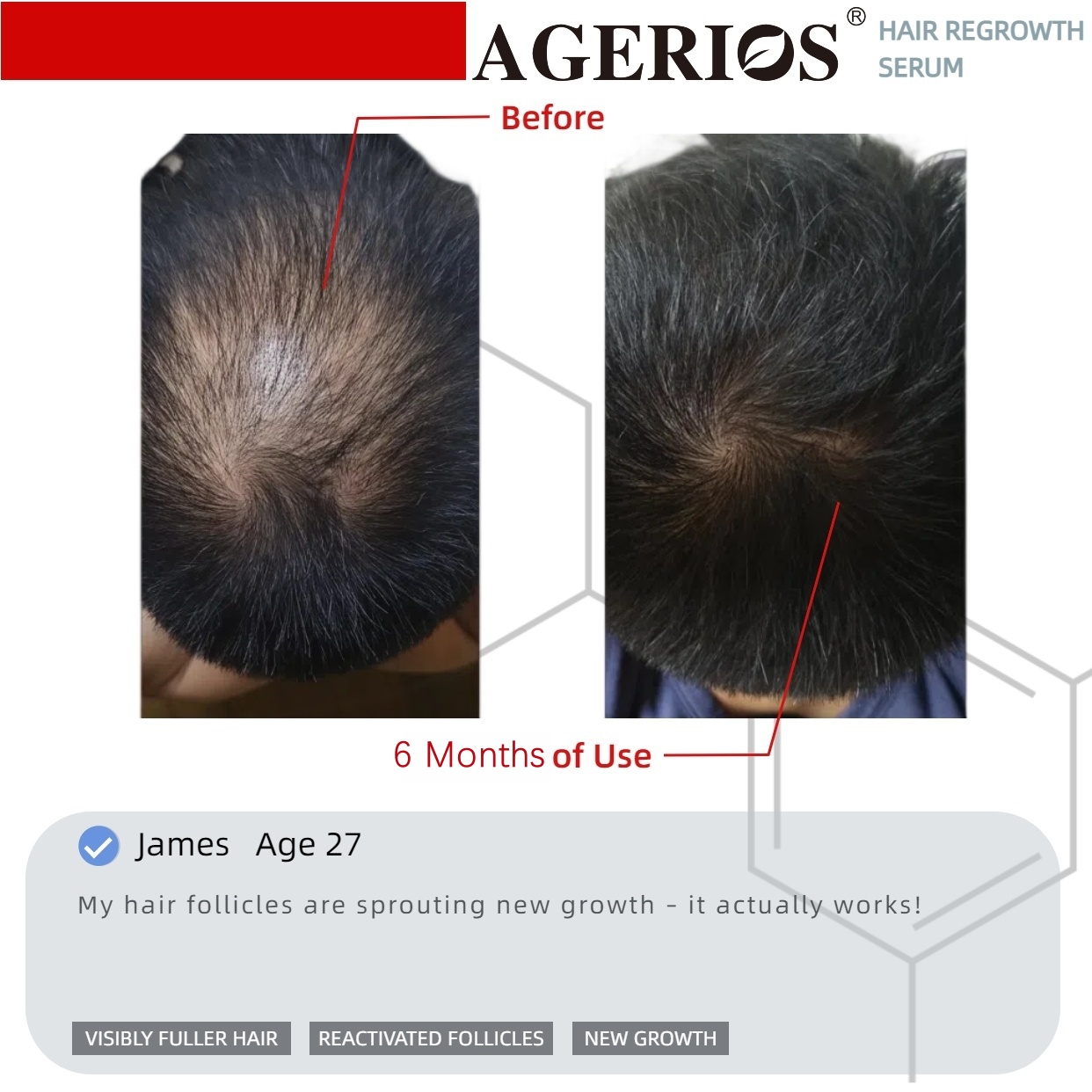 AGerios Hair Regrowth Serum