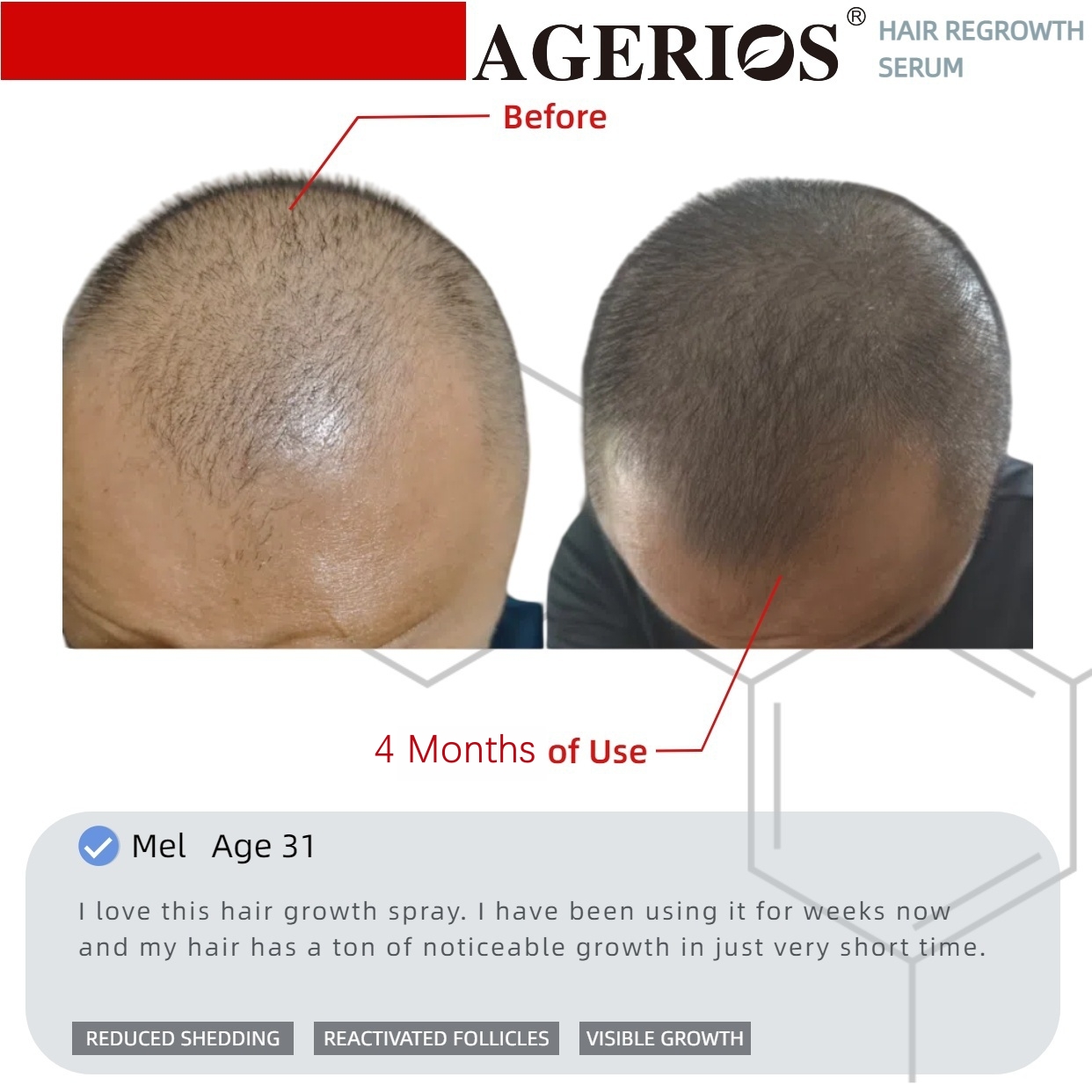 AGerios Hair Regrowth Serum