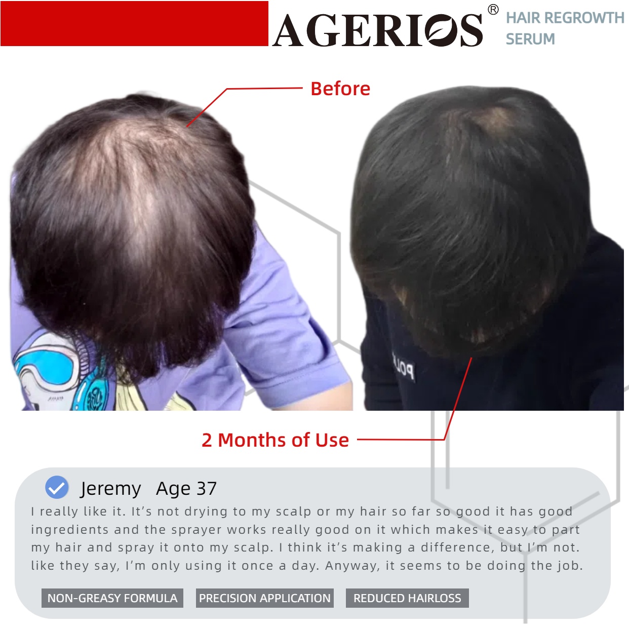 AGerios Hair Regrowth Serum