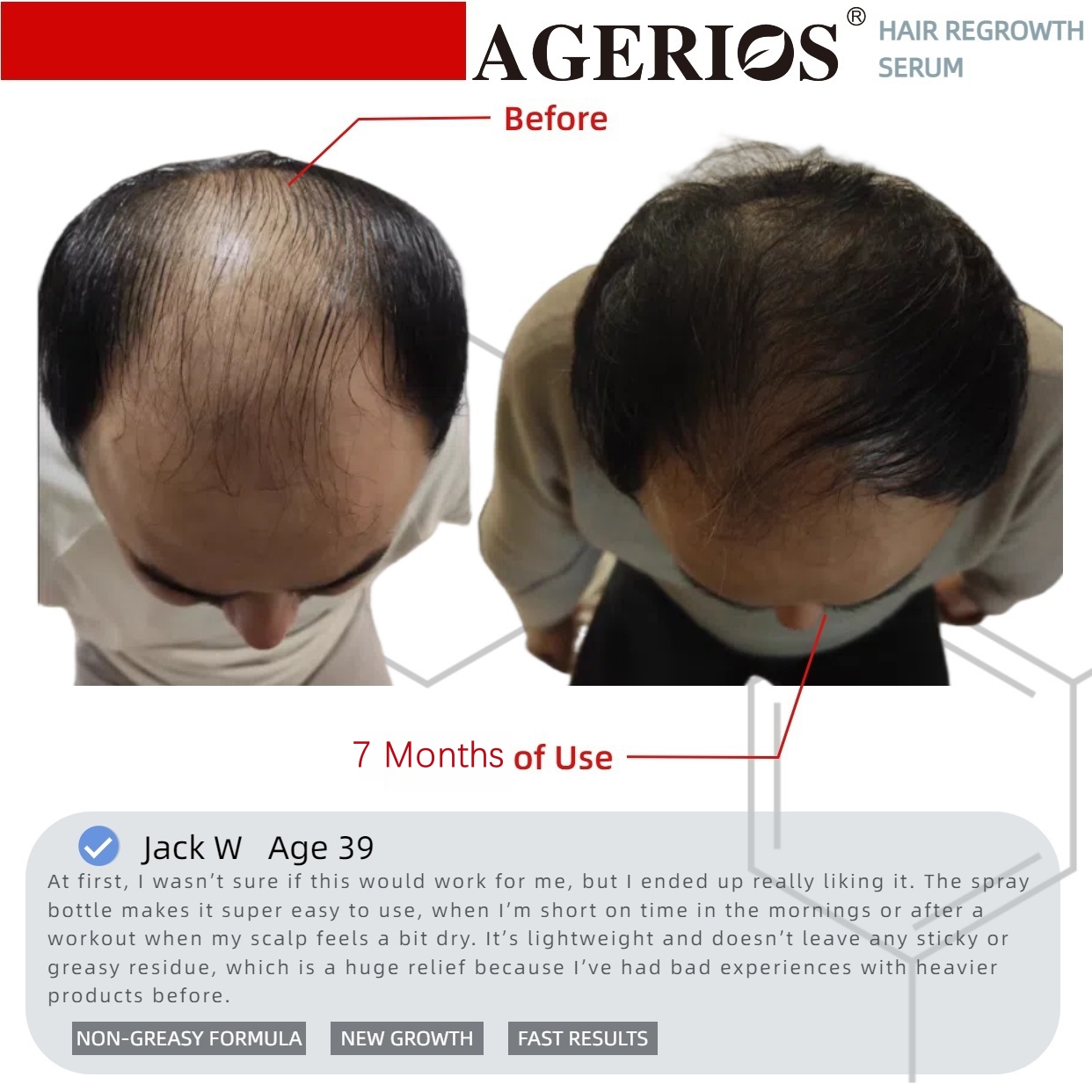 AGerios Hair Regrowth Serum