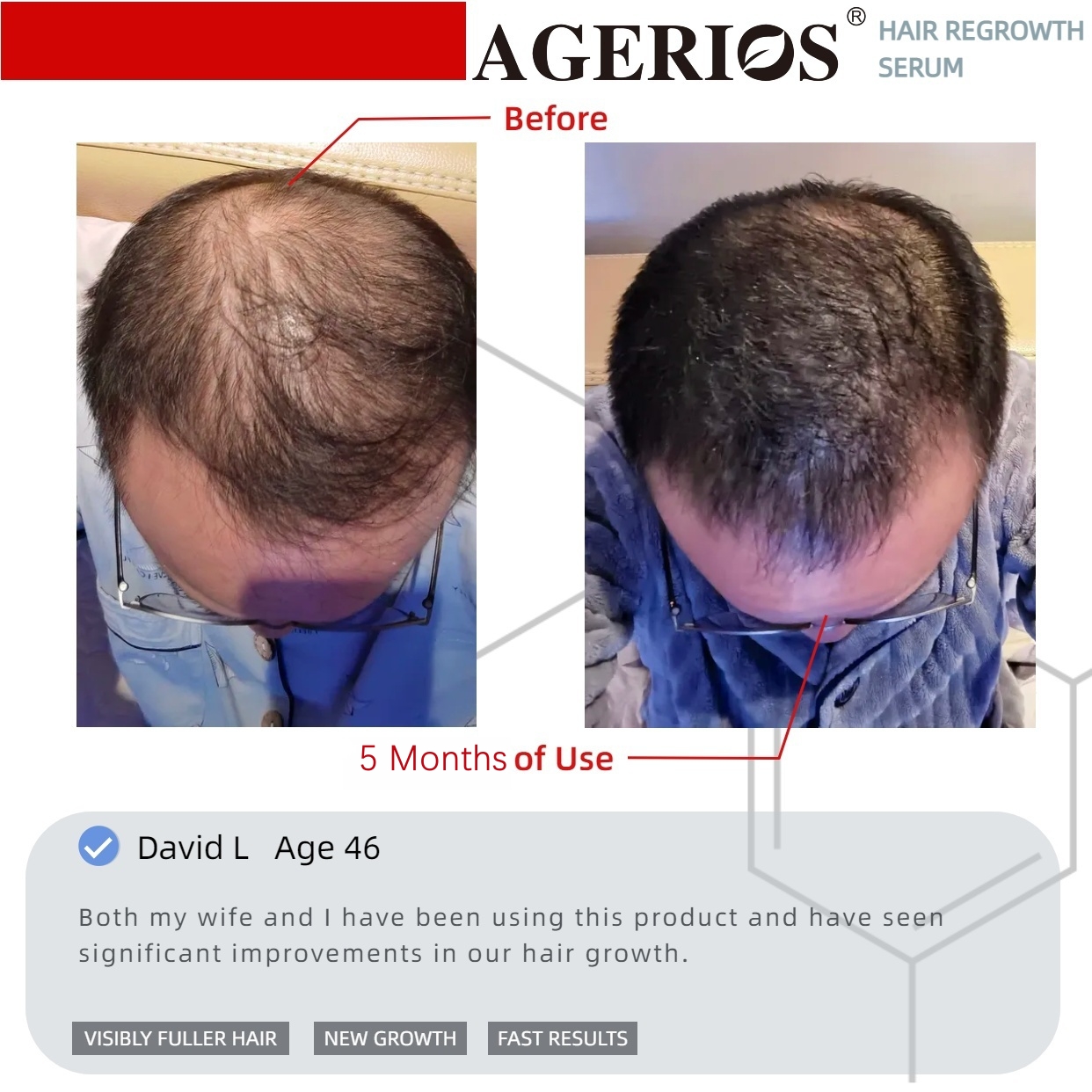 AGerios Hair Regrowth Serum