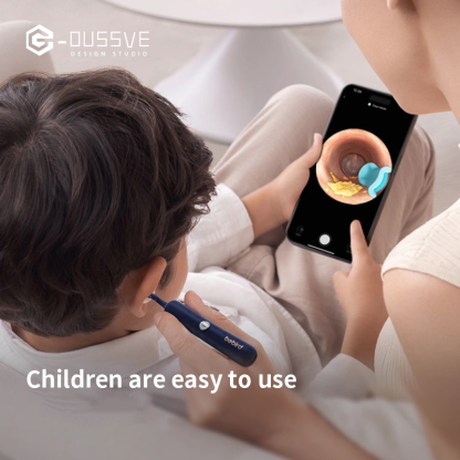 G-OUSSVE｜Visual ear pick – HD ear scoop and tweezers set, the ultimate ear-cleaning tool for kids and adults