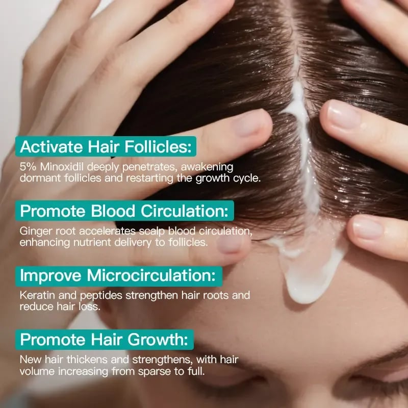 🎁Buy 1 Get 1 Free🎁5% Minoxidil Hair Growth Scalp Massage Cream with Keratin & Ginger