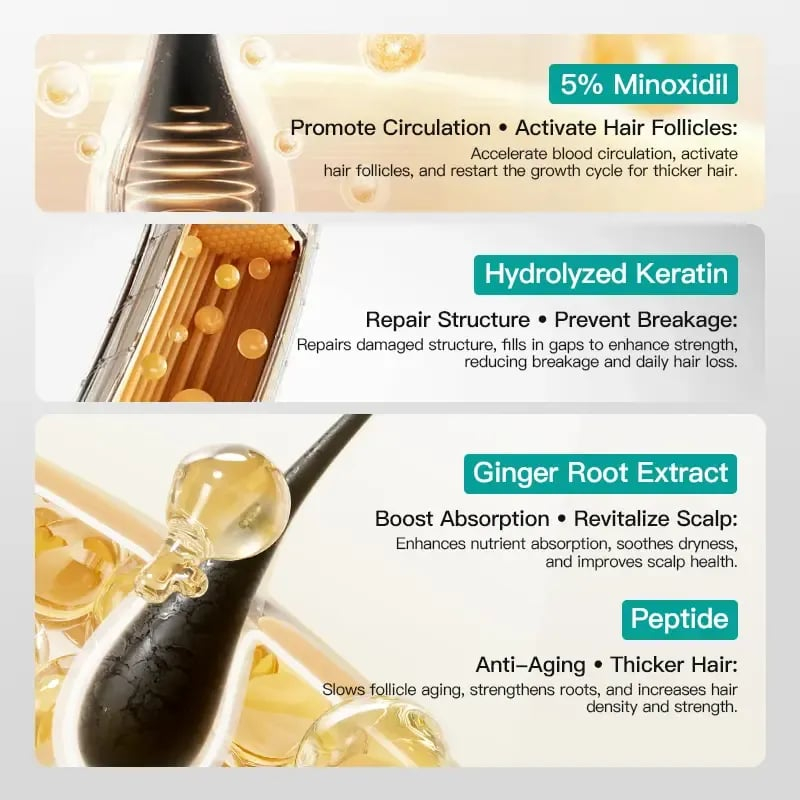 🎁Buy 1 Get 1 Free🎁5% Minoxidil Hair Growth Scalp Massage Cream with Keratin & Ginger