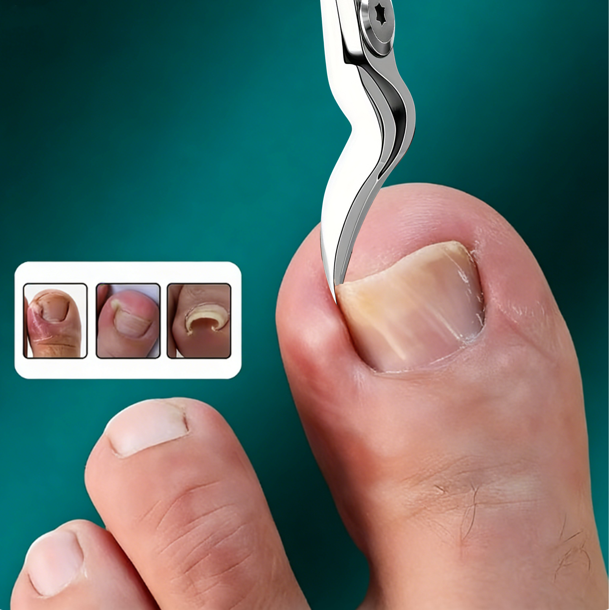 Heavy-Duty Stainless Steel Toenail & Fingernail Clipper for Thick Nails