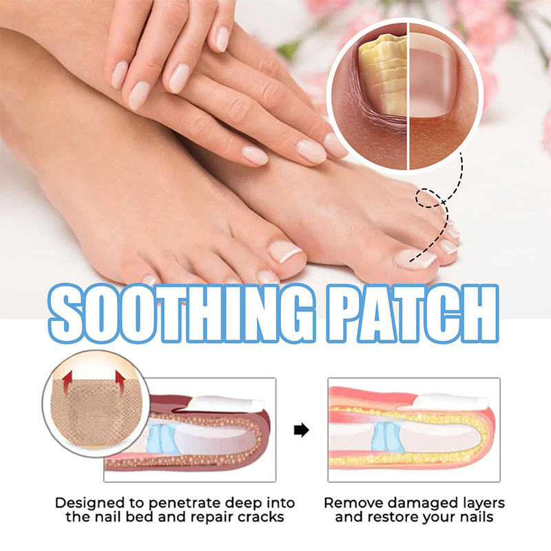 Toenail Fungus Treatment Extra Strength