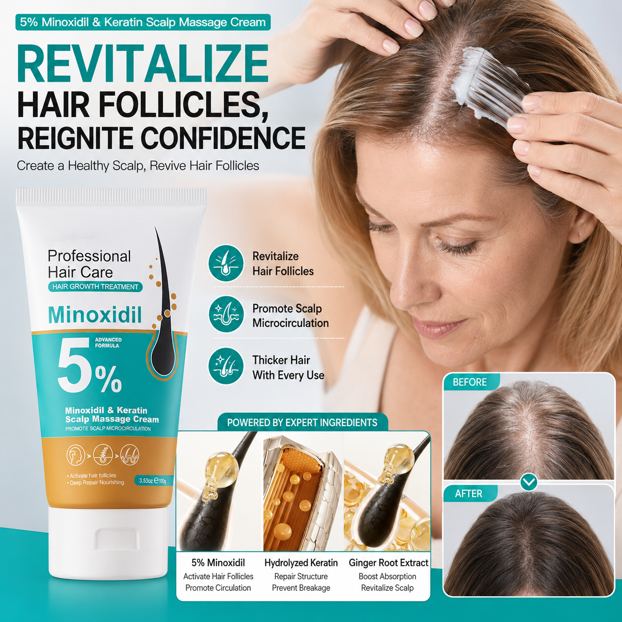 🎁Buy 1 Get 1 Free🎁5% Minoxidil Hair Growth Scalp Massage Cream with Keratin & Ginger
