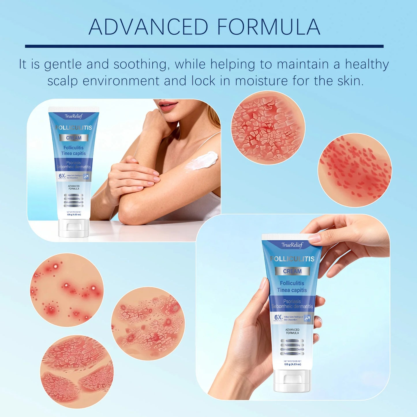 Folliculitis Cream | Clears Scalp, Face & Body Bumps | 120g