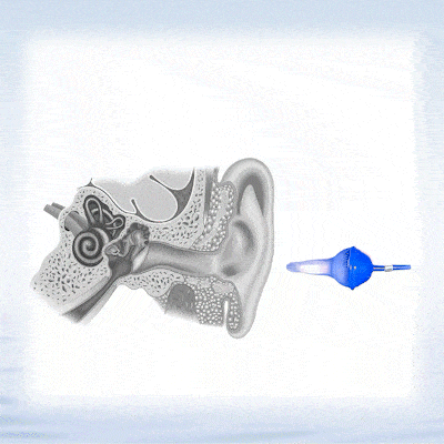 💥2025 NEW DESIGN-👂The World's First Fluid Inflatable Earplug