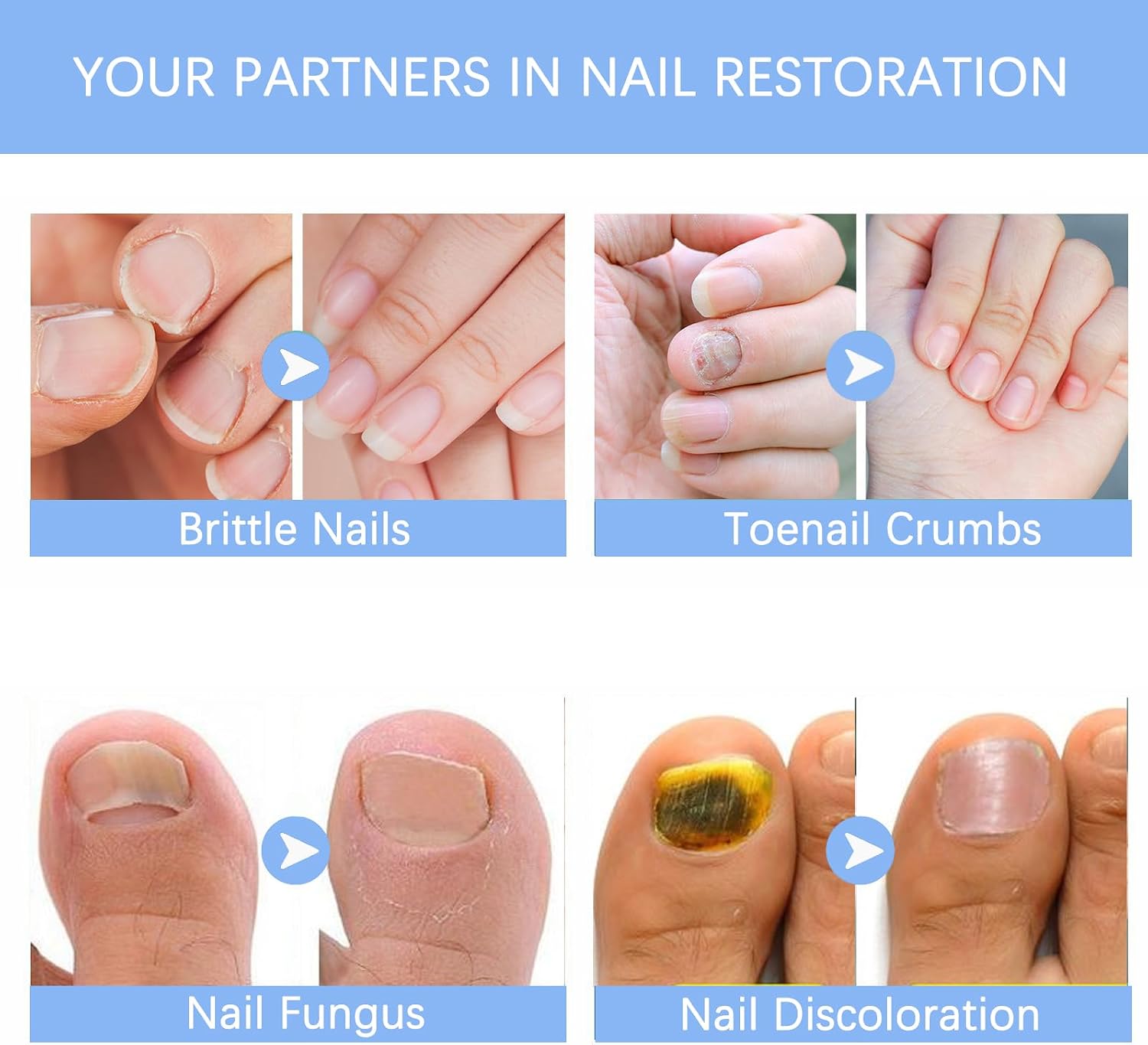Toenail Fungus Treatment Extra Strength