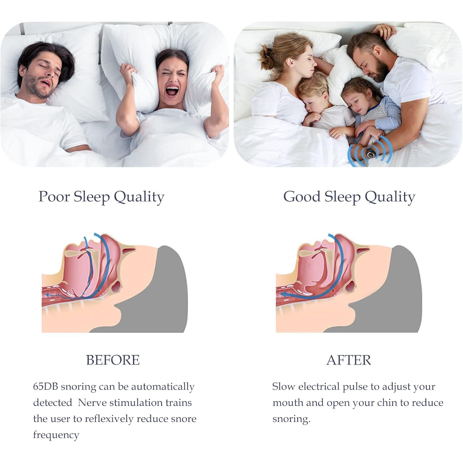 Stop Snoring Wristband Anti-snoring watch