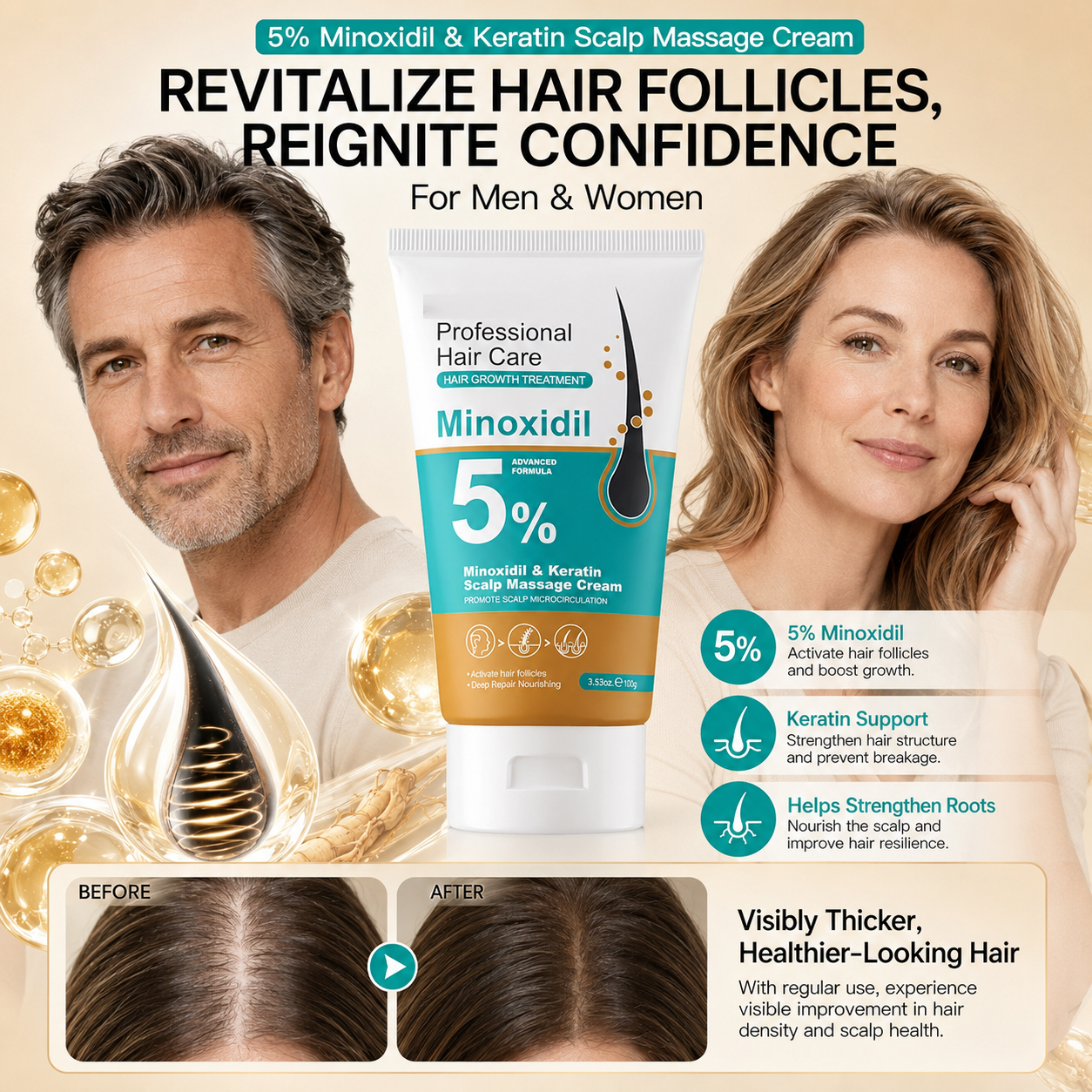 🎁Buy 1 Get 1 Free🎁5% Minoxidil Hair Growth Scalp Massage Cream with Keratin & Ginger