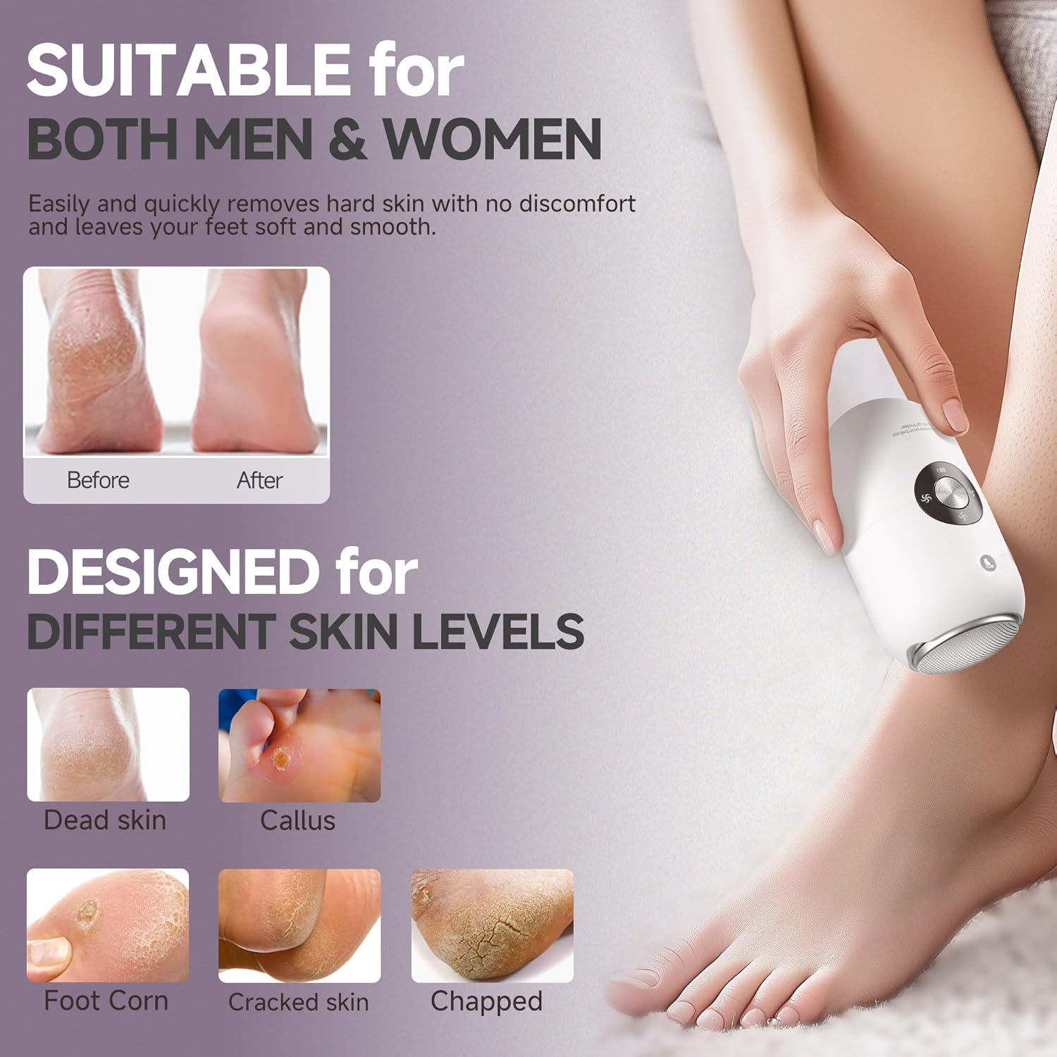 Electric Foot Callus Remover