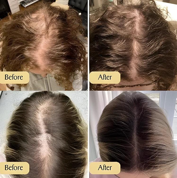 Welnax™ Red Light Therapy Brush