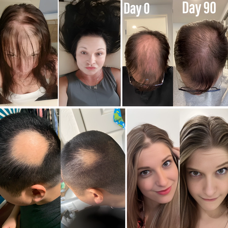 Welnax™ Red Light Therapy Brush