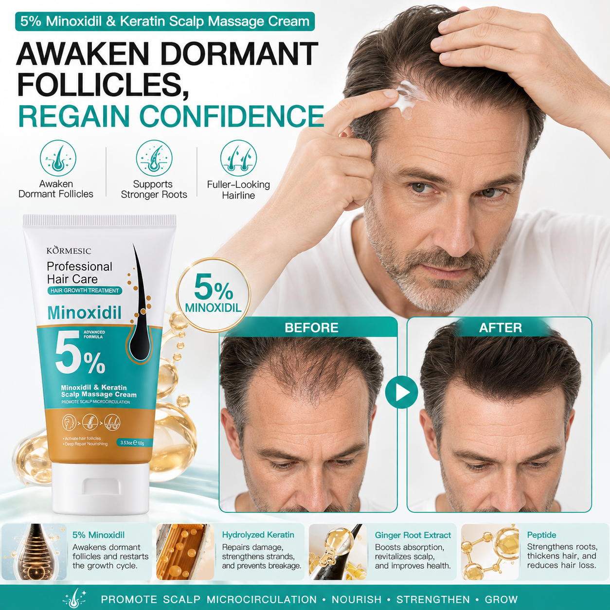 🎁Buy 1 Get 1 Free🎁5% Minoxidil Hair Growth Scalp Massage Cream with Keratin & Ginger