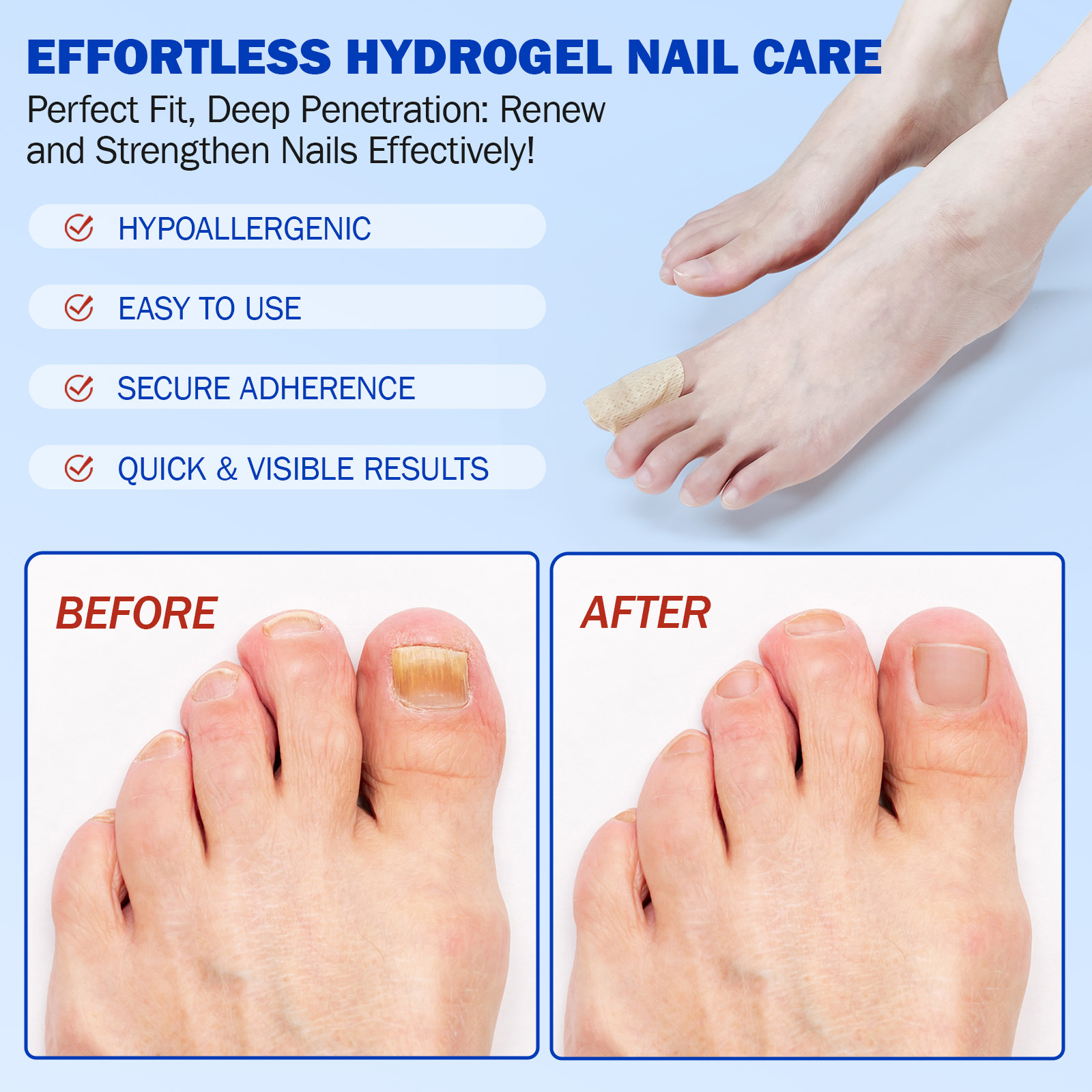 Fungal Nail Renewal Patches