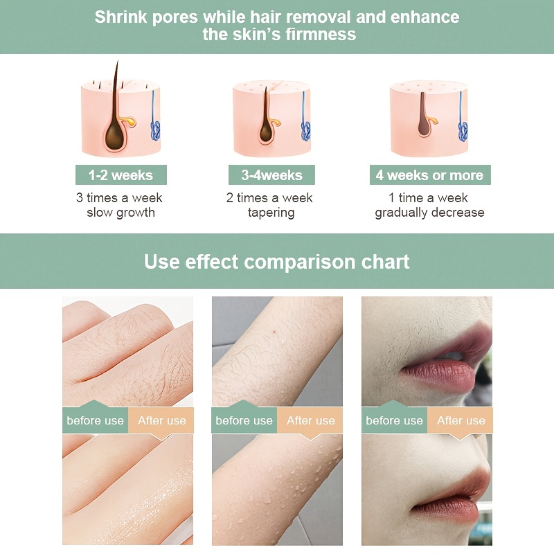 IPL Ice Painless Laser Hair Removal Device