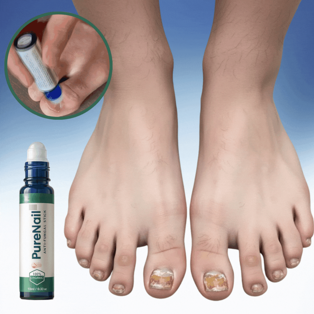 Pure Nail Transforms Thick, Yellow Nails into Healthy Pink Ones Within 48 Hours!