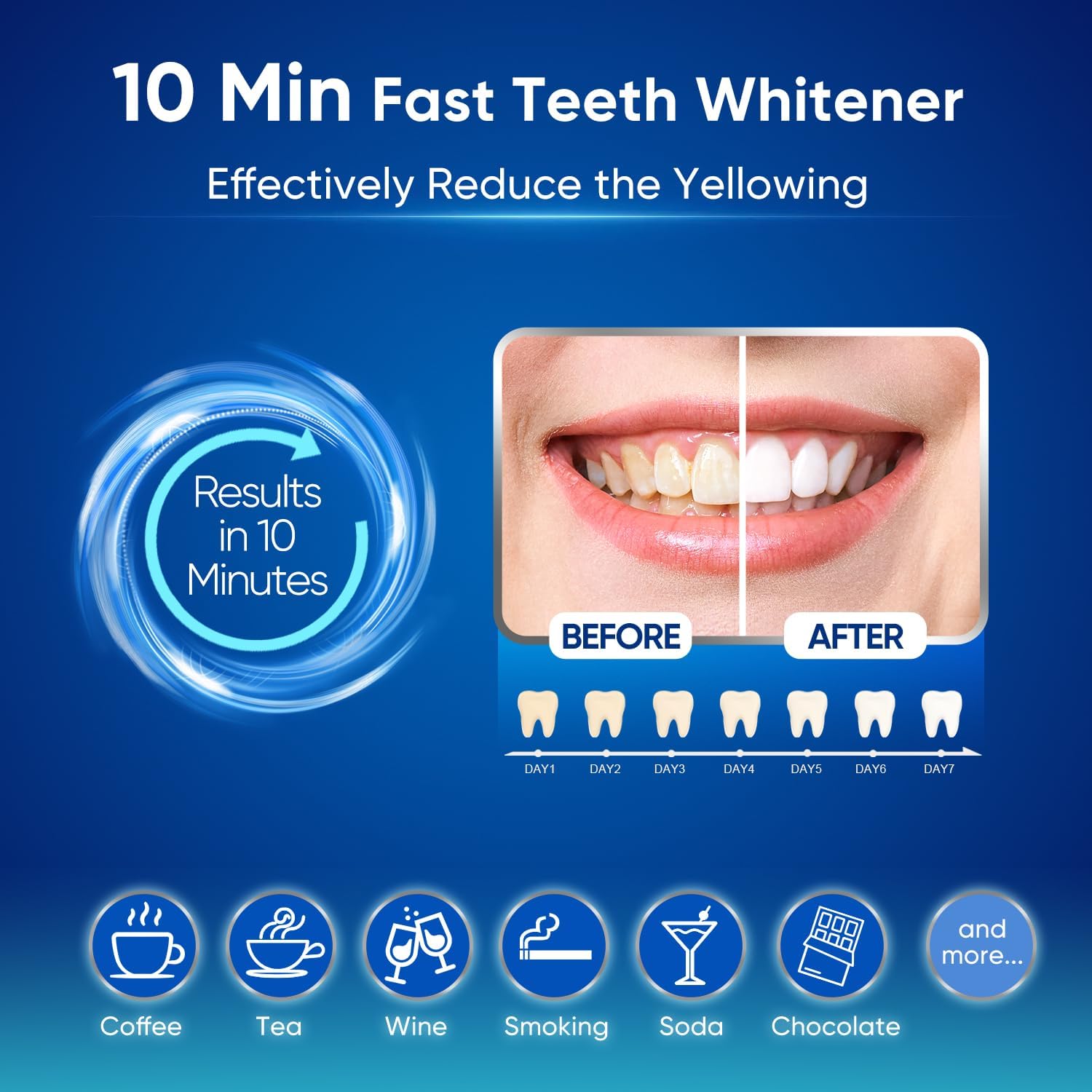  Blue Light Teeth Whitening Kit