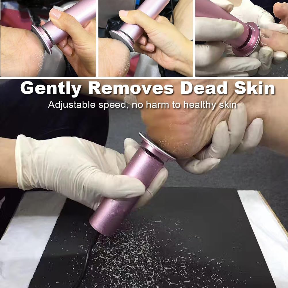 Electric Foot Callus Remover