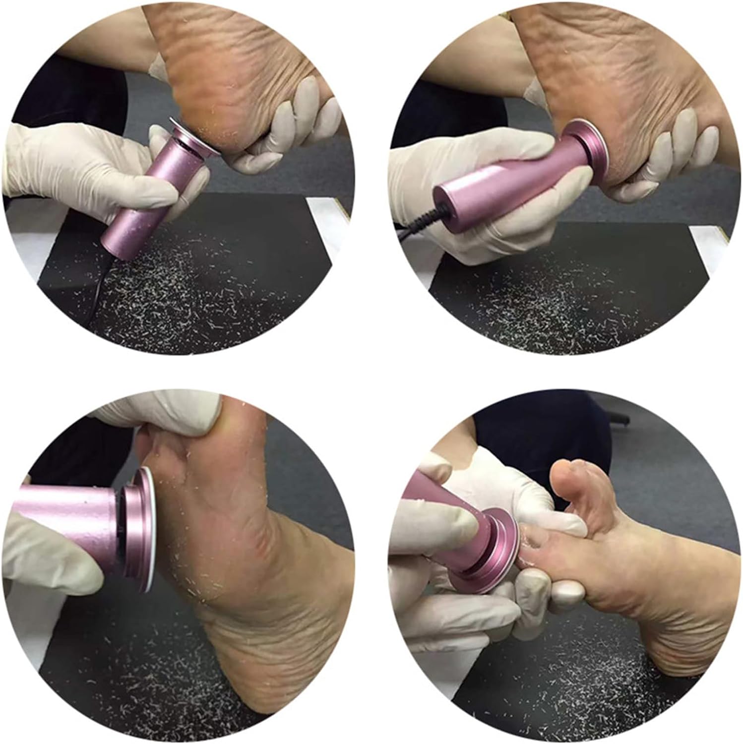 Electric Foot Callus Remover