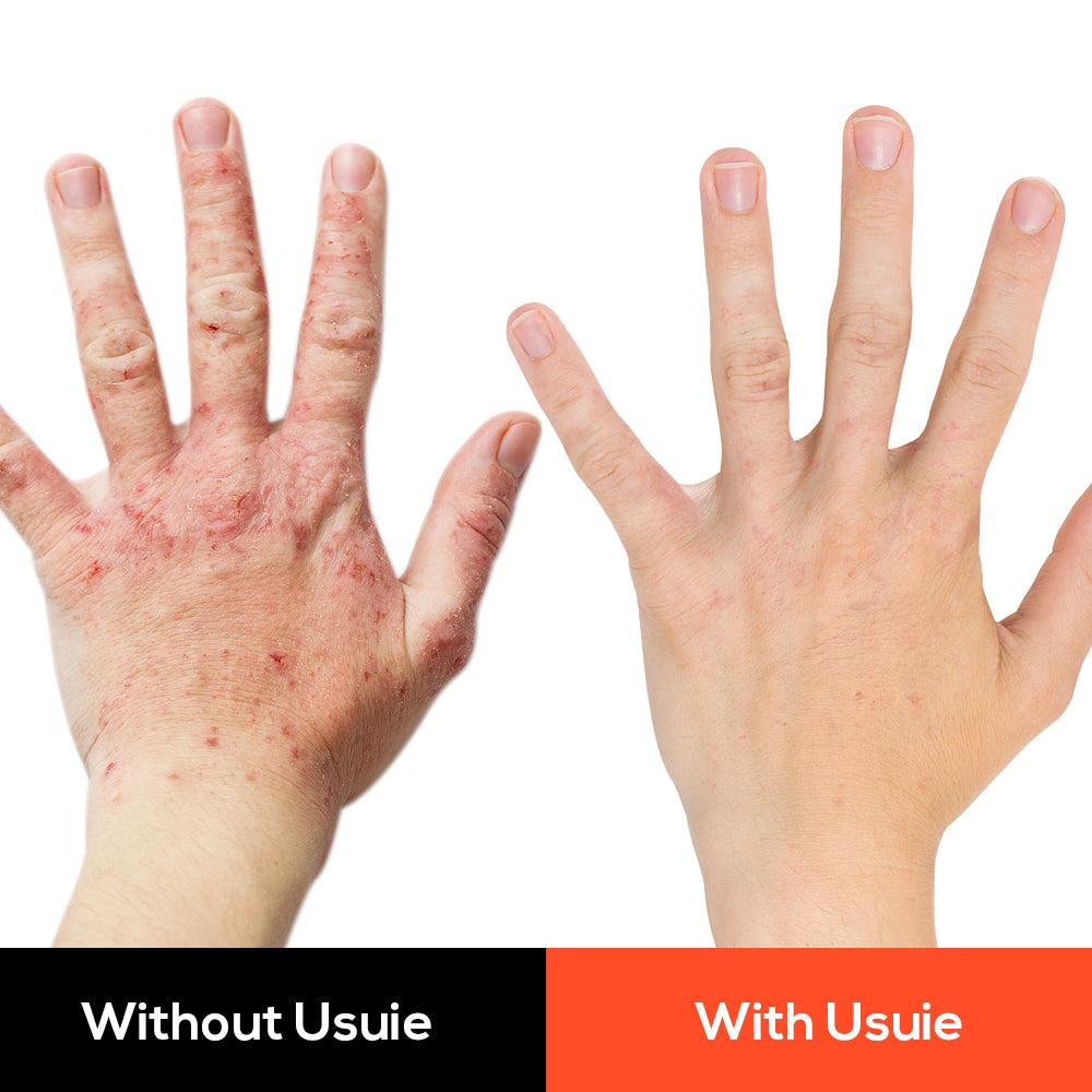 Infrared Light Therapy Glove