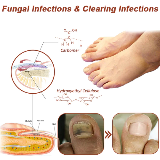 Revolutionary High-Efficiency Light Therapy Device For Toenail Diseases