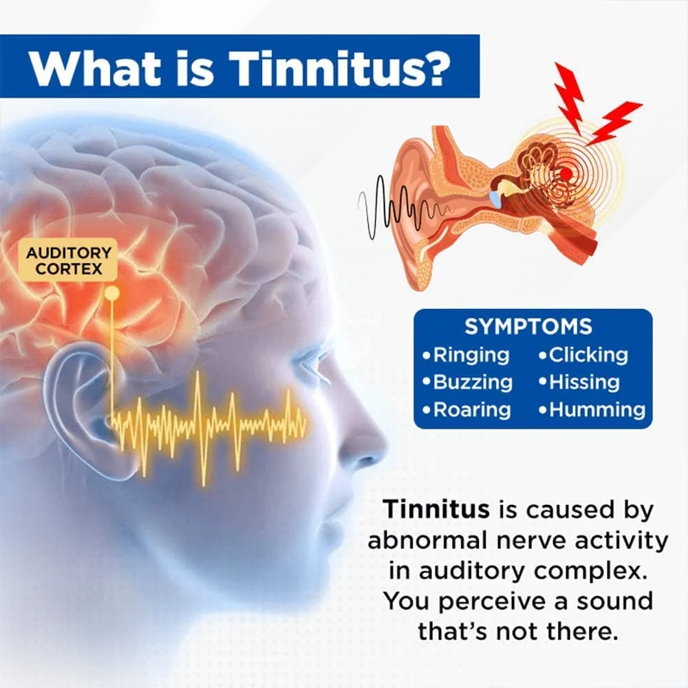 🔥 2023 New Tinnitus Relief Device