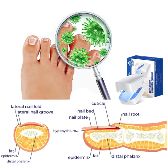 Revolutionary High-Efficiency Light Therapy Device For Toenail Diseases
