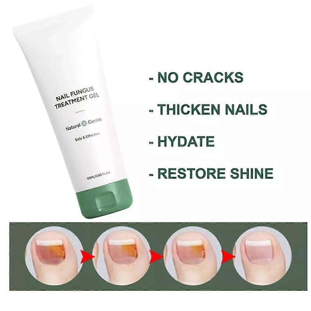 Antifungal Gel - Get rid of nail fungus fast!