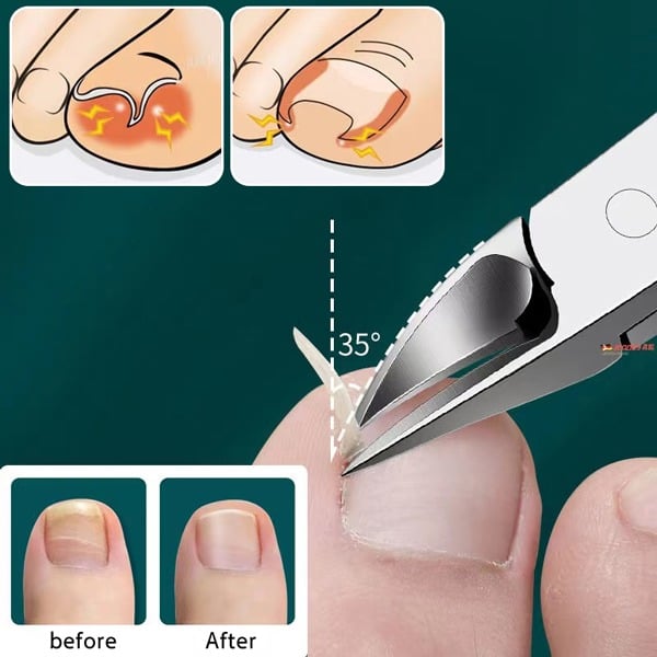 (🎁2023-Christmas Hot Sale🎁)🔥 49% OFF🔥Professional Nail Clipper