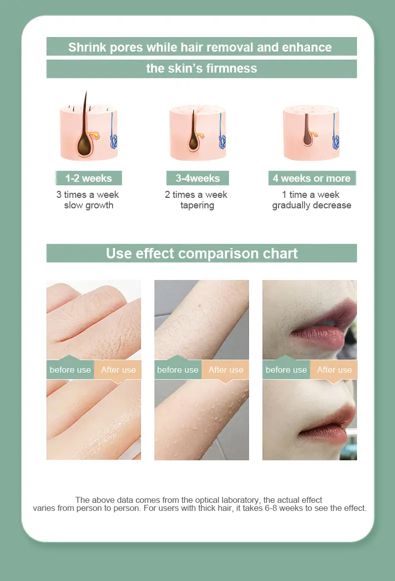 1pc effective and safety ipl hair removal device for women and men permanent hair removal 999 999 flashes painless hair remover on armpits back legs arms face bikini line 5 different modes also help to smooth skin 7 08 x2 68 details 3