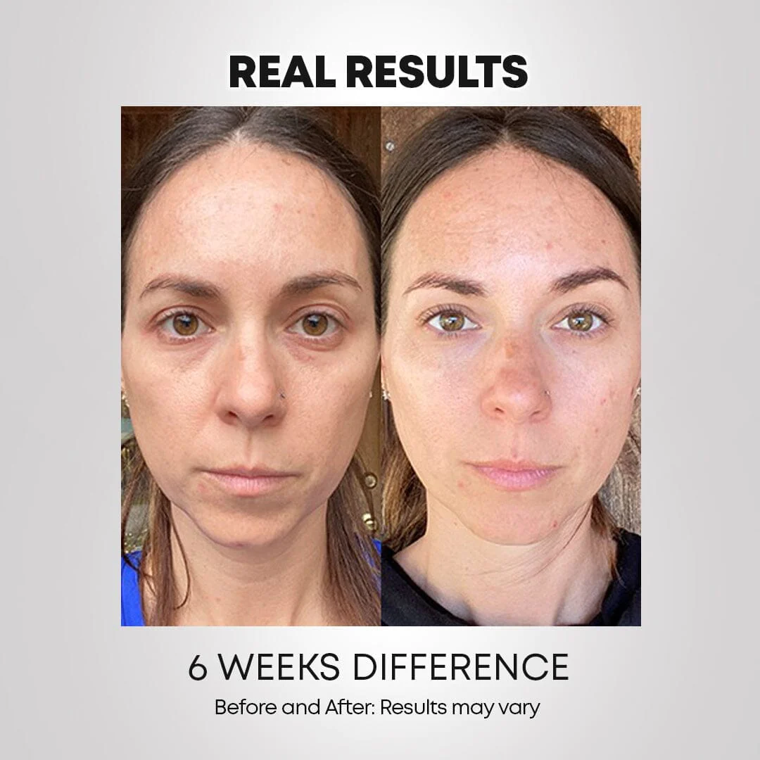 LED Light-Therapy Revitalizing Mask