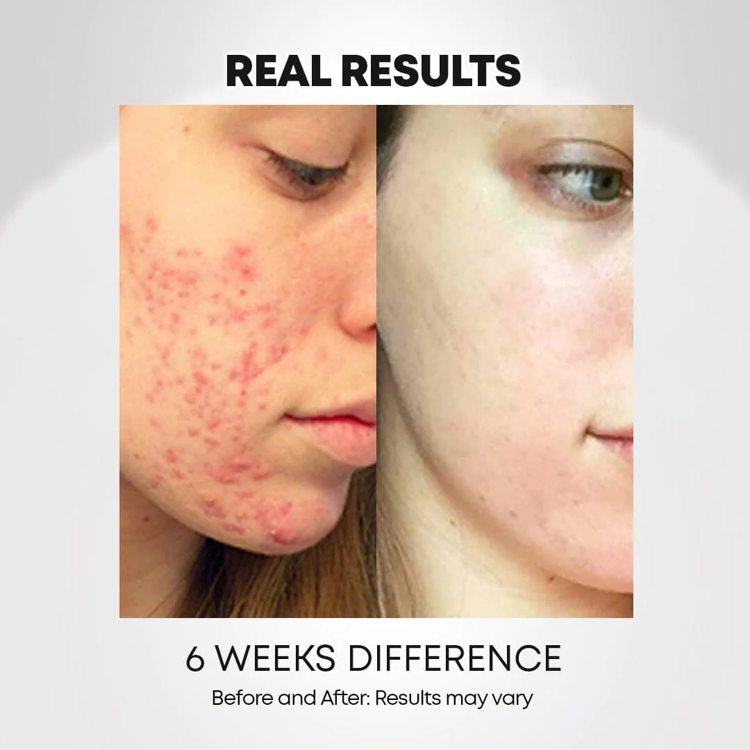 LED Light-Therapy Revitalizing Mask