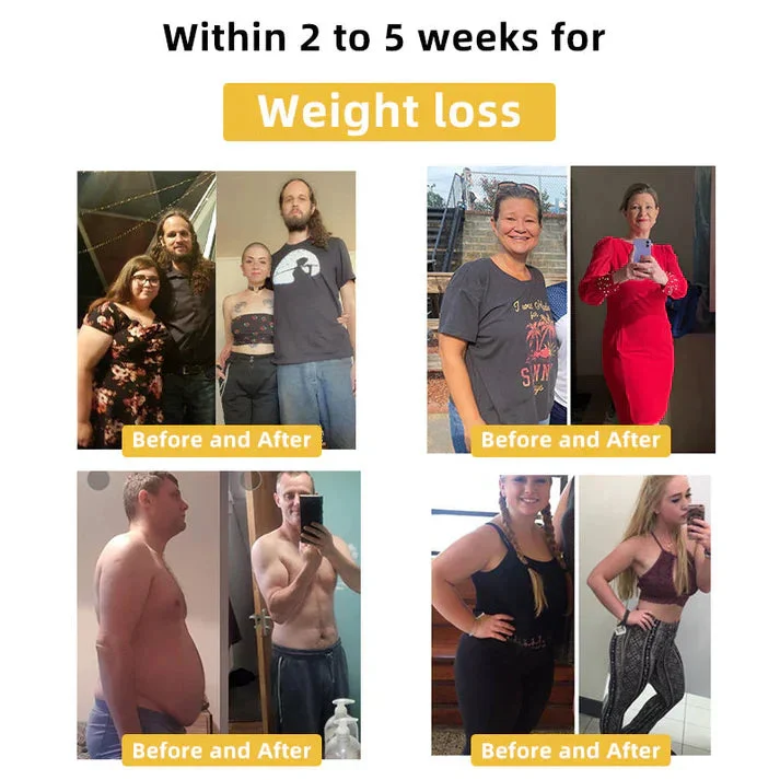 Bee Venom Slimming Patch