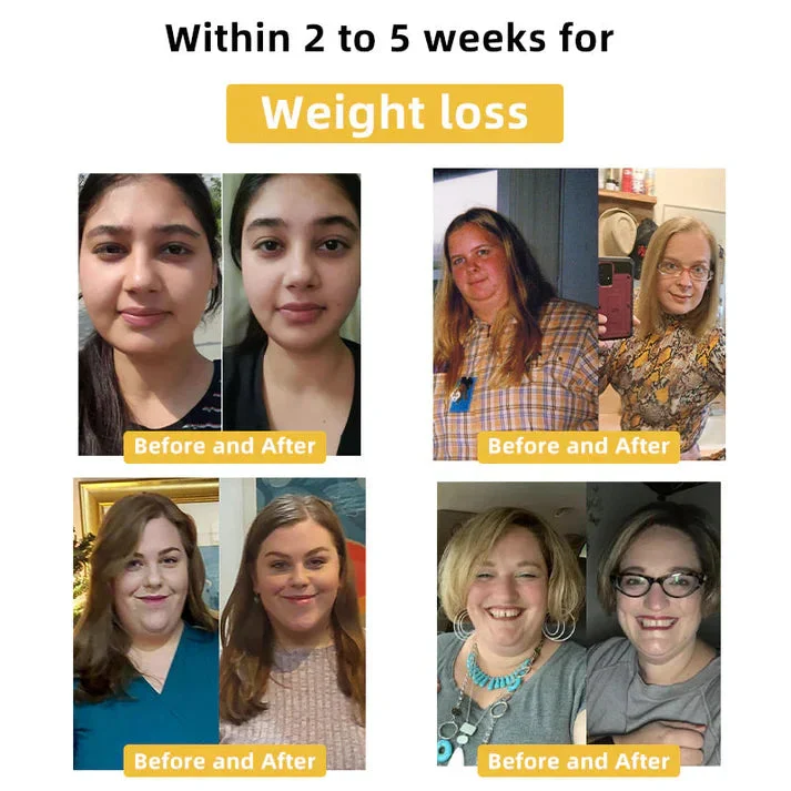 Bee Venom Slimming Patch